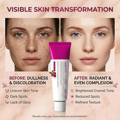 Arbutin Brightening Moisturiser | Dark Spot Corrector & Face Cream for Uneven Skin Tone | Hydrating Niacinamide Daily Lotion for Radiance & Glow | Lightweight & Non-Greasy