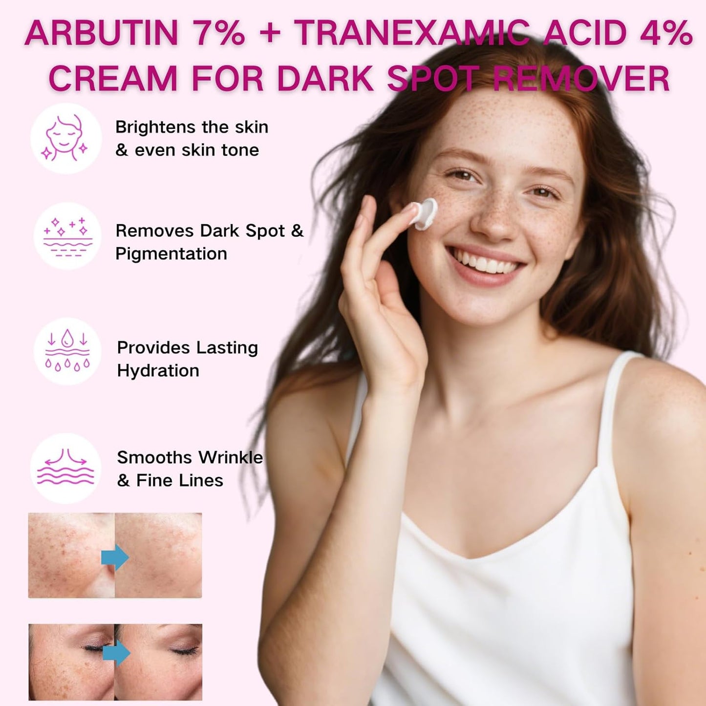 2PCS Arbutin 7% + Tranexamic Acid 4% Cream, Dark Spot Remover with Glutathione & Niacinamide, Hyperpigmentation, Skin Lightening Cream for Freckle, Blemishes, Pigmentation, Korean Skincare