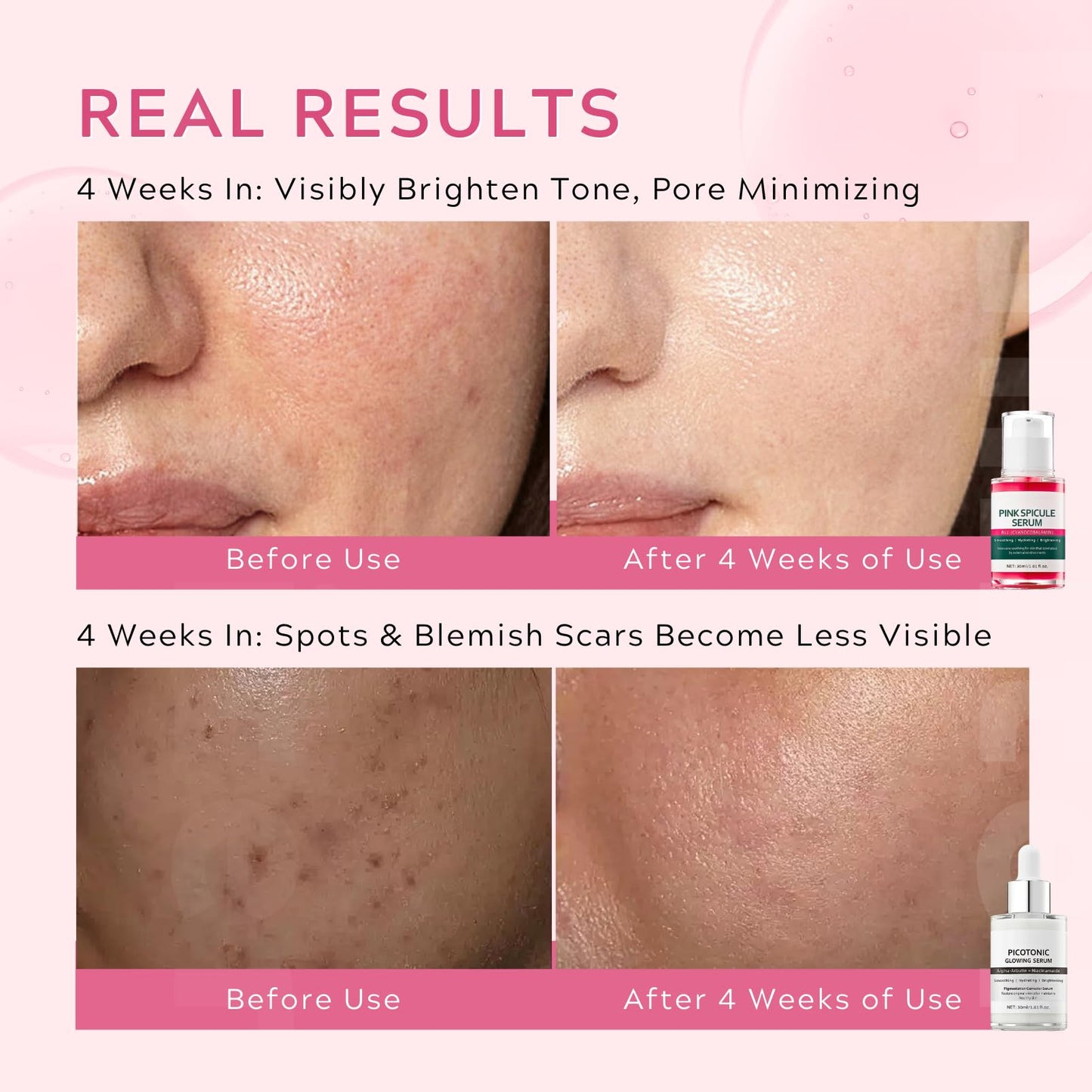 Pink Spicule Serum + Picotonic Shot Ampoule + Peel Shot Exfoliant Rice Ampoule, Rice Exfoliator for Face Pore Refining, Picotonic Glow Serum for Pigmentation & Dark Spot, Glass Skin, 3PCS