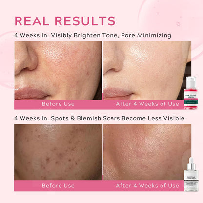 Pink Spicule Serum + Picotonic Shot Ampoule + Peel Shot Exfoliant Rice Ampoule, Rice Exfoliator for Face Pore Refining, Picotonic Glow Serum for Pigmentation & Dark Spot, Glass Skin, 3PCS