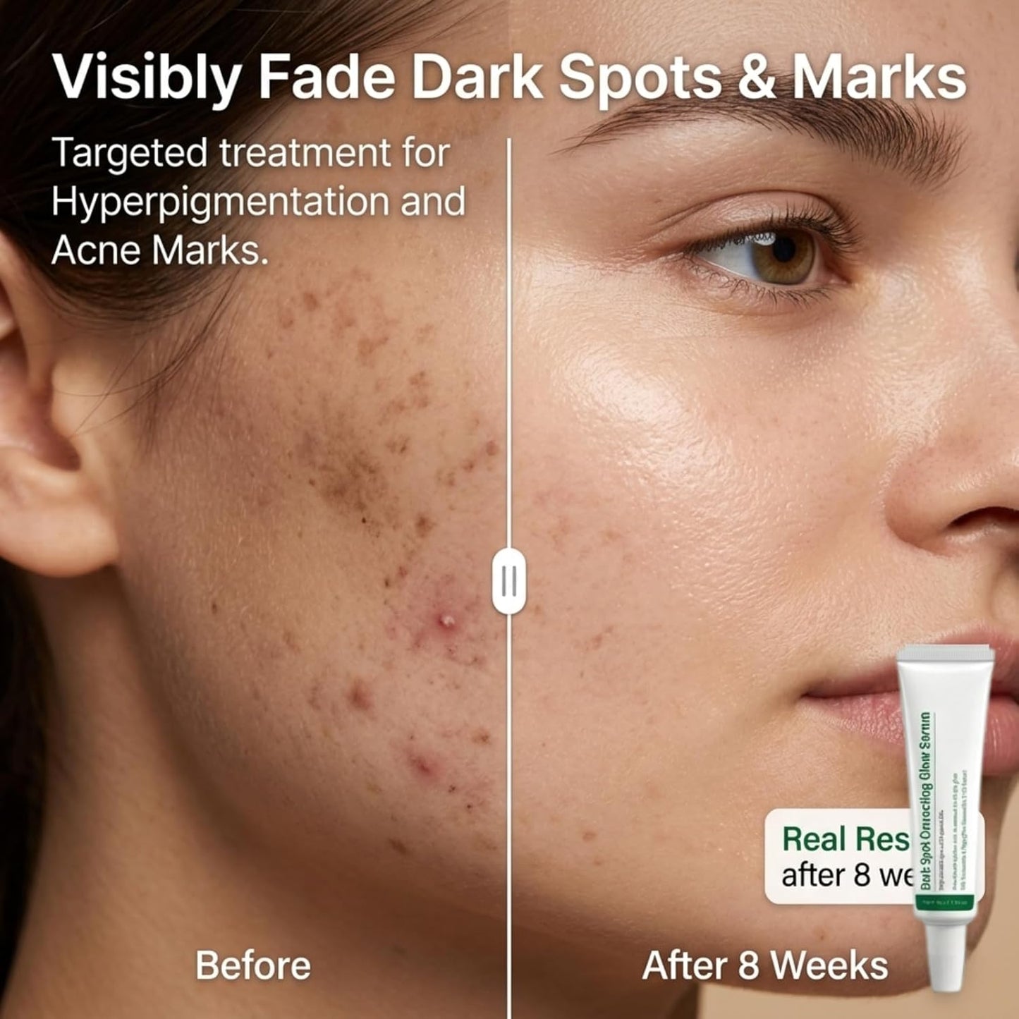 Dark Spot Correcting Glow Serum for Face, Niacinamide Serum for Hyperpigmentation & Skin Brightening, Dark Spot Remover Essence to Fade Pore Marks & Even Skin Tone, Intense Hydrating Formula, 40g*2