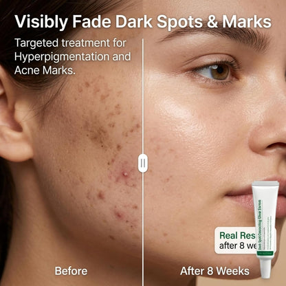 Dark Spot Correcting Glow Serum for Face, Niacinamide Serum for Hyperpigmentation & Skin Brightening, Dark Spot Remover Essence to Fade Pore Marks & Even Skin Tone, Intense Hydrating Formula, 40g*2