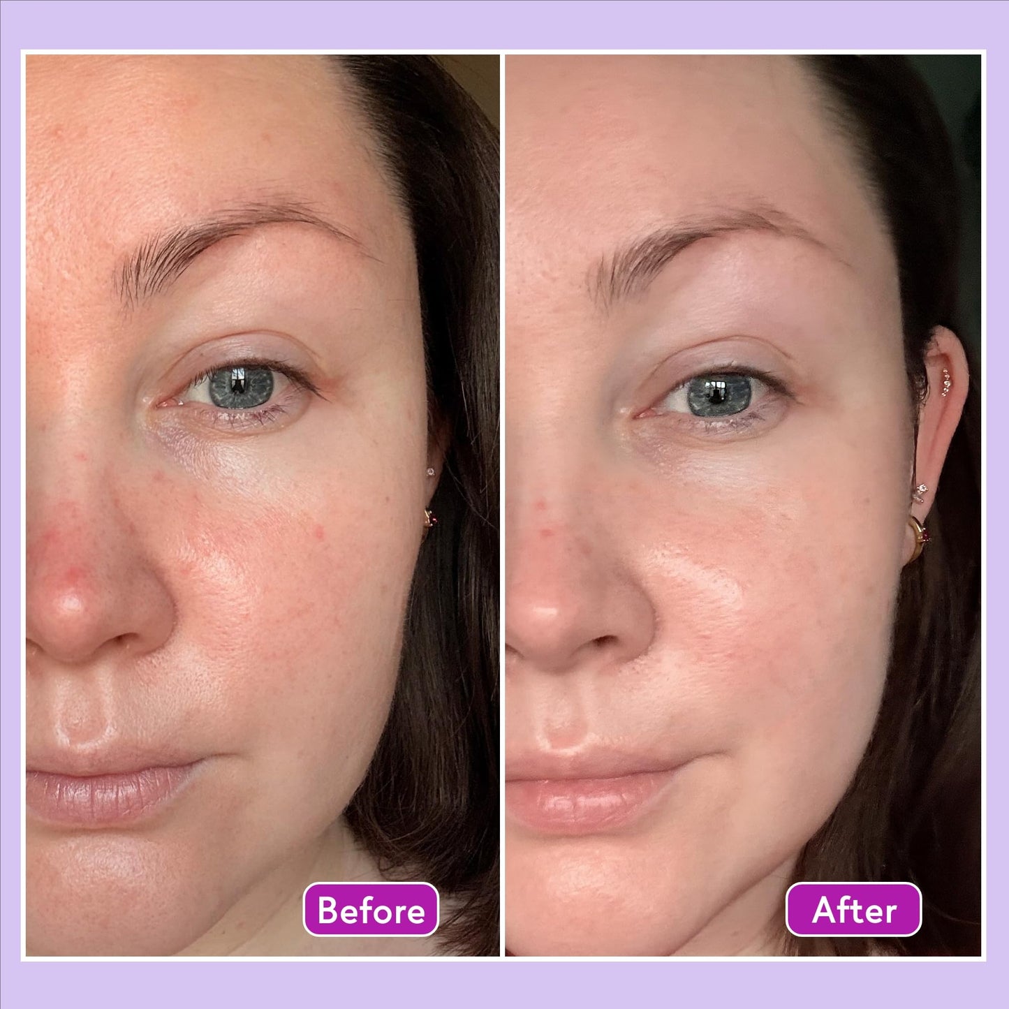 Q+A Hyaluronic Acid Facial Serum (30ml), Natural Hydrating Face Serum, for Plump Skin, Anti Ageing, Fragrance Free, Delivers Deep, Lasting Hydration, Rehydrates and Softens the Skin