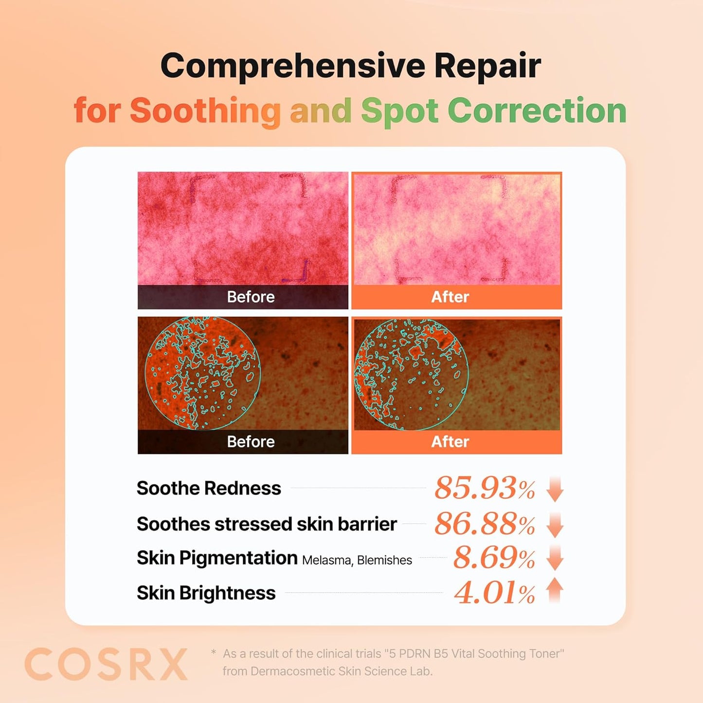COSRX 5 PDRN B5 Vital Soothing Toner 280mL for Rejuvenating & Soothing Skin with Salmon DNA, Centella, Lactobacillus PDRN & Panthenol, Korean Skin Care