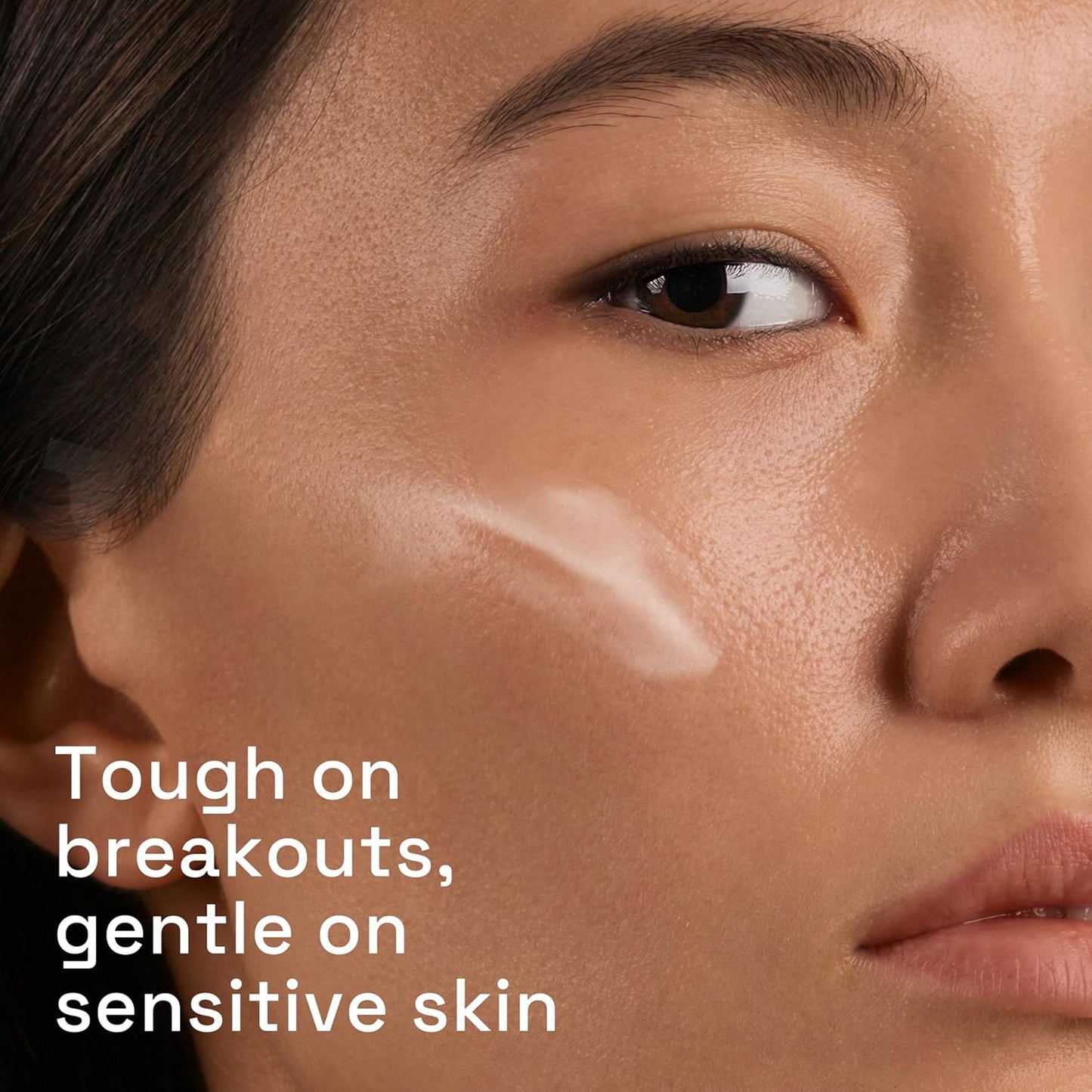 Cetaphil Gentle Clear Triple-Action Blemish Serum 30ml, with 0.5% Salicylic Acid and Niacinamide for Blemish-prone Sensitive Skin, Packaging May Vary