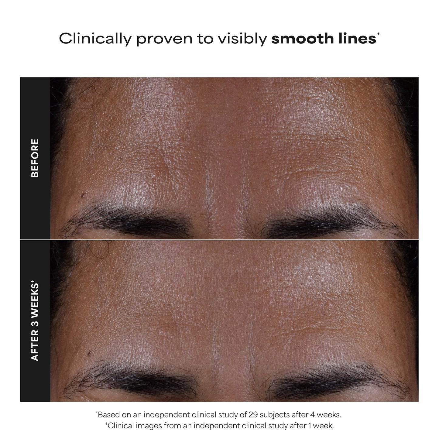 Paula's Choice SKIN PERFECTING 2% BHA Liquid Exfoliant - Face Exfoliating Peel Fights Blackheads & Enlarged Pores - for a Healthy Glow - with Salicylic Acid - Combination & Oily Skin - 30 ml