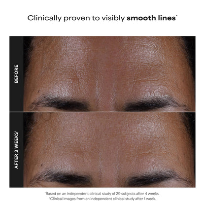 Paula's Choice SKIN PERFECTING 2% BHA Liquid Exfoliant - Face Exfoliating Peel Fights Blackheads & Enlarged Pores - for a Healthy Glow - with Salicylic Acid - Combination & Oily Skin - 30 ml