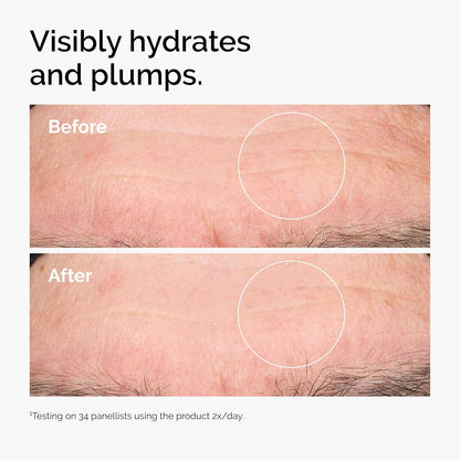 The Ordinary Hyaluronic Acid 2% + B5 (with Ceramides), Multi-Depth Hydration Serum for Plumper, Smoother Skin, 30ml