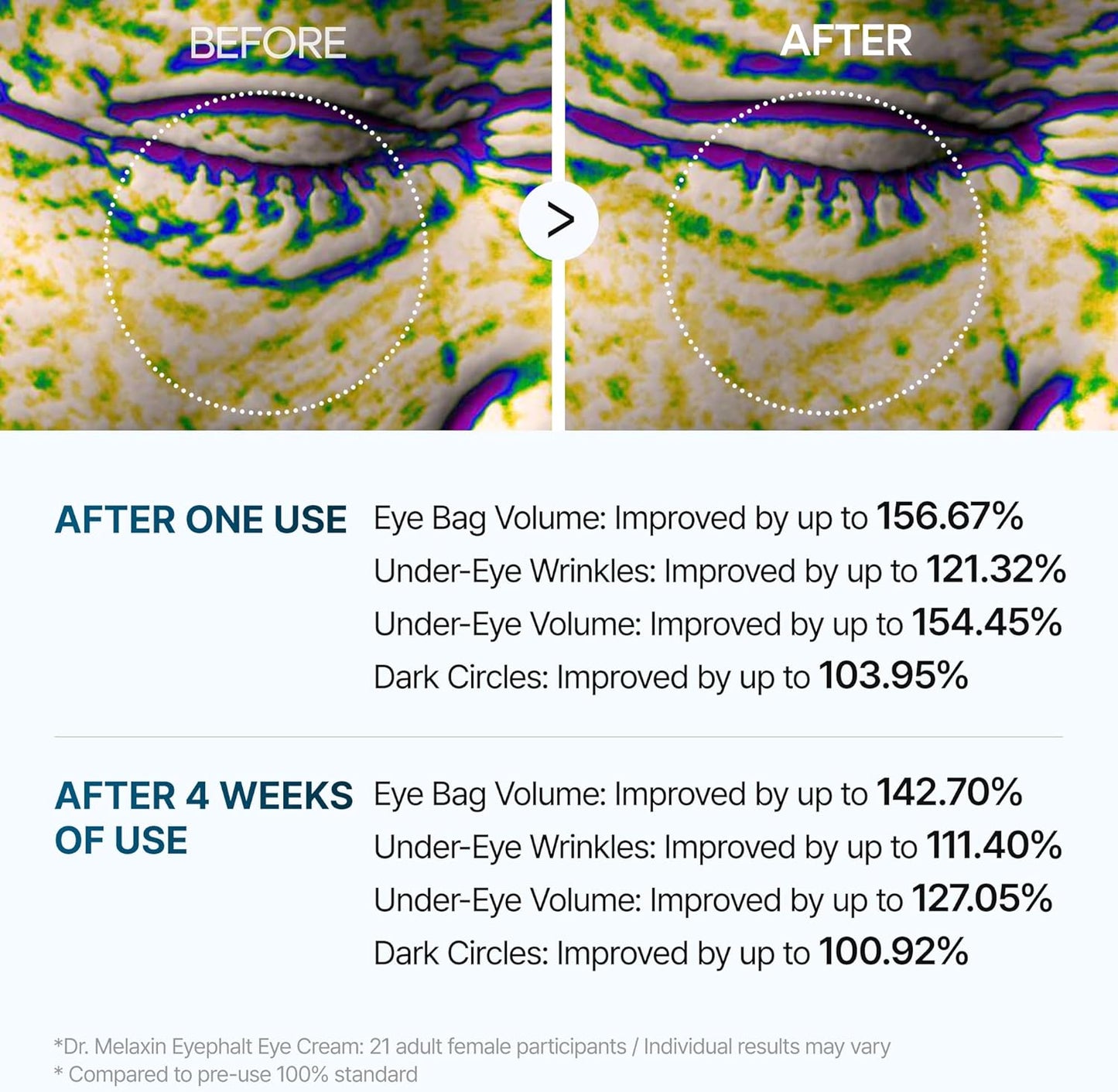 Dr.Melaxin Eyephalt Eye Cream (10g / 0.35 oz) – Under Eye Cream for Eye Bags & Puffiness, Firming & Lifting Eye Treatment for Dark Circles & Wrinkles, EGF K-Beauty