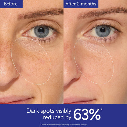 Caudalie Vinoperfect Brightening Dark Spot Serum Vitamin C Alternative - 62x More Effective than Vitamin C with Viniferine and Niacinamide for a Visibly Brighter Even Complexion - 30ml