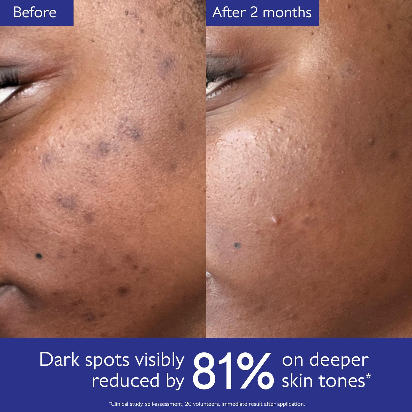 Caudalie Vinoperfect Brightening Dark Spot Serum Vitamin C Alternative - 62x More Effective than Vitamin C with Viniferine and Niacinamide for a Visibly Brighter Even Complexion - 30ml