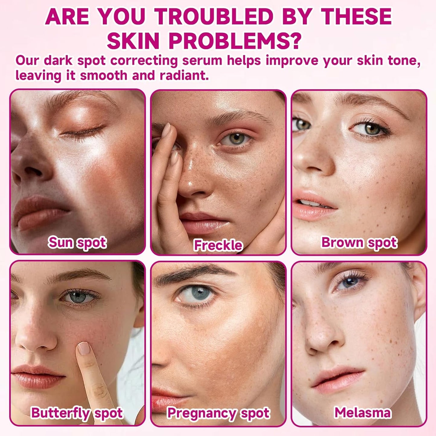 2 Pcs Arbutin 7% + Tranexamic Acid 4% Cream,Moisturiser Arbutin Cream,Dark Spot Remover for Face Uneven Skin Tone
