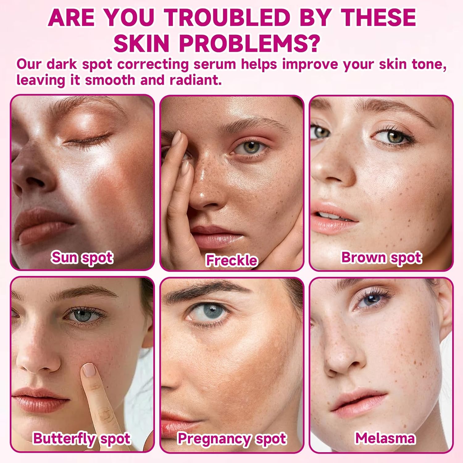 2 Pcs Arbutin 7% + Tranexamic Acid 4% Cream,Moisturiser Arbutin Cream,Dark Spot Remover for Face Uneven Skin Tone