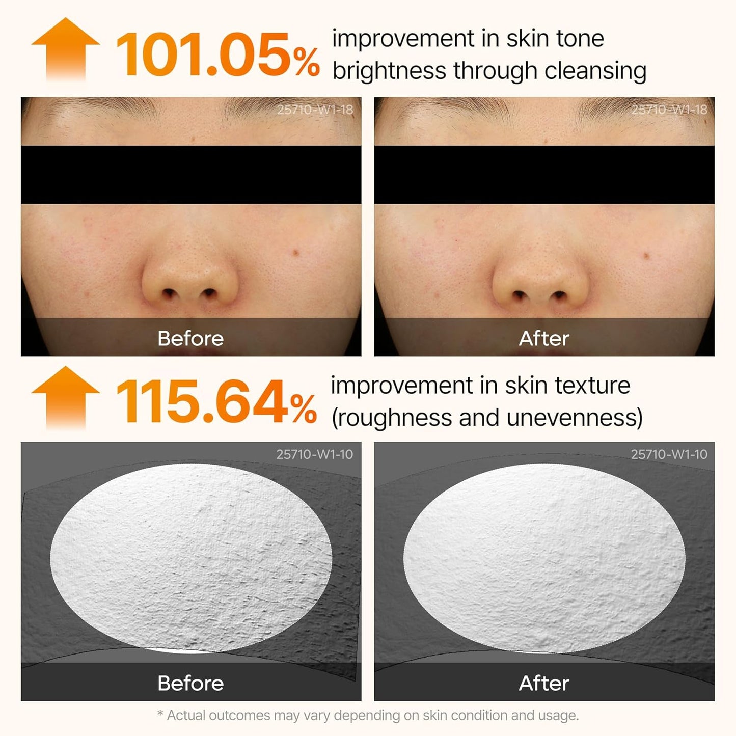 Dr.Melaxin Peel Shot Kojic Acid Turmeric Serum Exfoliating Dark Spot Corrector With Aha/Bha & Niacinamide, Brightening & Even Tone Facial Serum 2.71 Fl Oz (Pack of 1)