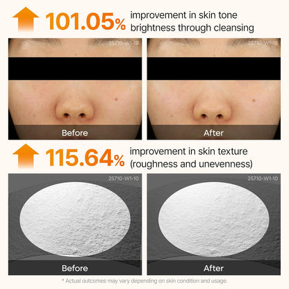 Dr.Melaxin Peel Shot Kojic Acid Turmeric Serum Exfoliating Dark Spot Corrector With Aha/Bha & Niacinamide, Brightening & Even Tone Facial Serum 2.71 Fl Oz (Pack of 1)