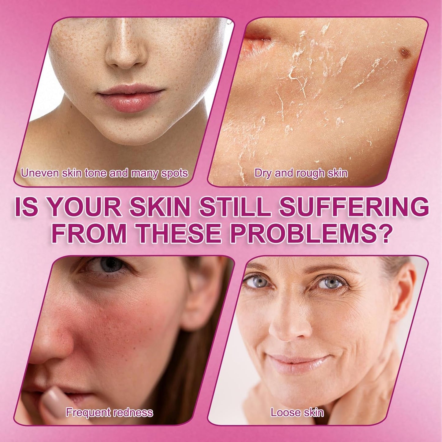 2 Pcs Arbutin 7% + Tranexamic Acid 4% Cream, Arbutin Cream for Face Moisturiser, Even Skin Tone, Gentle Skincare