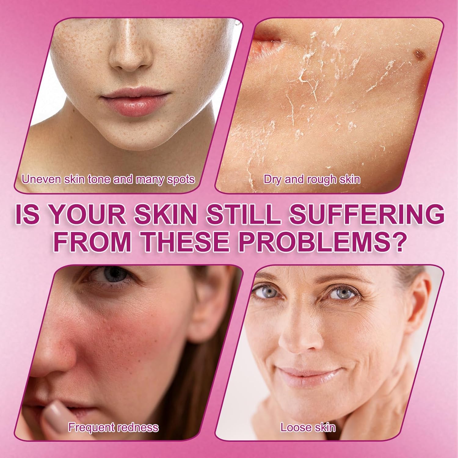 2 Pcs Arbutin 7% + Tranexamic Acid 4% Cream, Arbutin Cream for Face Moisturiser, Even Skin Tone, Gentle Skincare