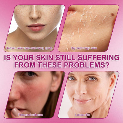 2 Pcs Arbutin 7% + Tranexamic Acid 4% Cream, Arbutin Cream for Face Moisturiser, Even Skin Tone, Gentle Skincare